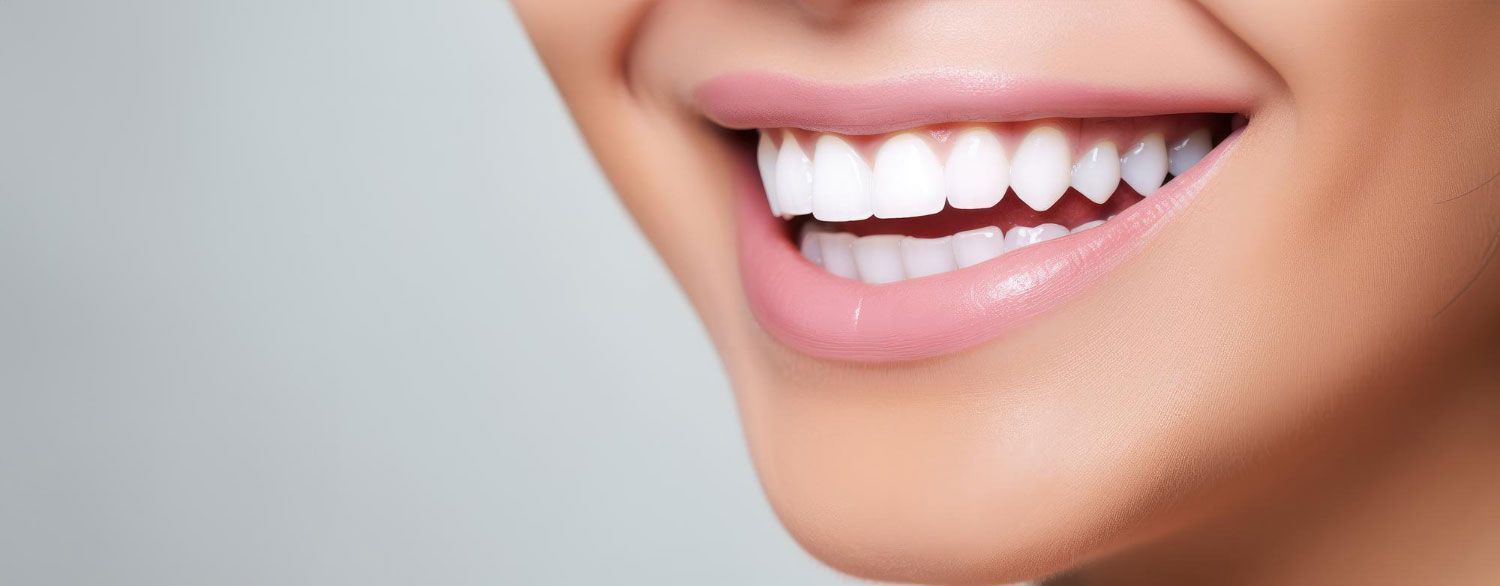 A close up of a woman 's smile with white teeth.