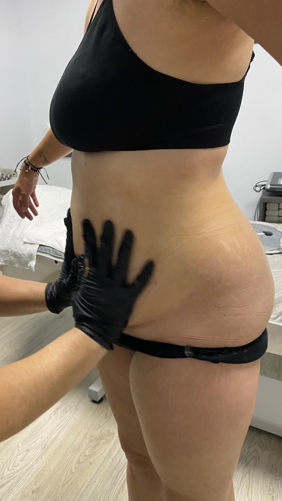 Se examina el torso de una persona; una mano enguantada palpa el costado. Viste ropa negra (parte superior e inferior) y se encuentra en el interior.