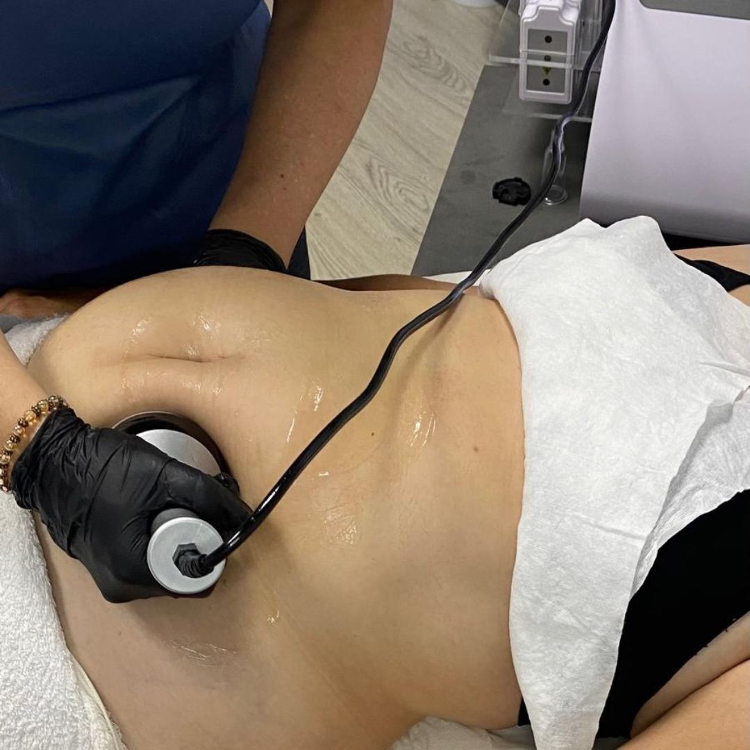 Persona recibiendo un tratamiento corporal. Un técnico mueve un dispositivo sobre el torso de la persona, que está tumbada.