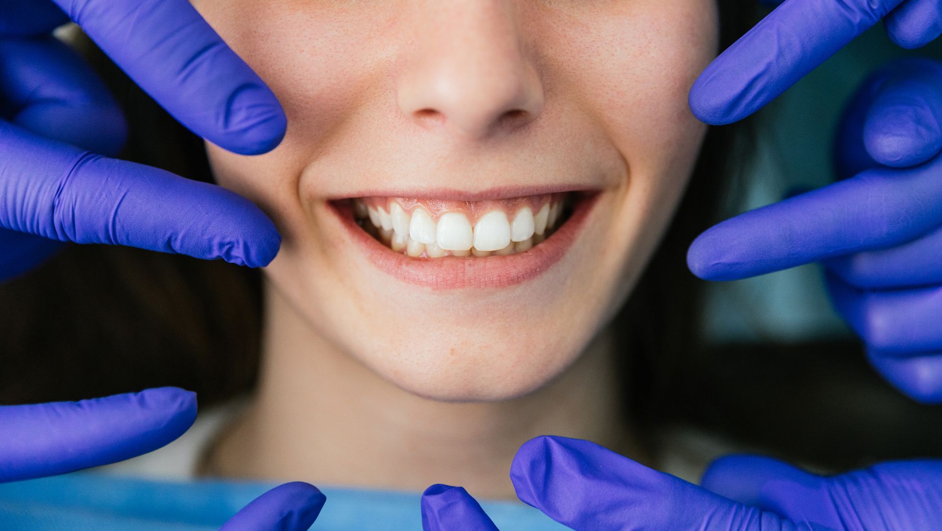 Dentists wearing blue gloves showing the perfect teeth of a young woman.