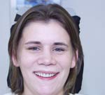 Image of a woman after treatment | Dental veneers in Osborne, KS to repair and reshape teeth.