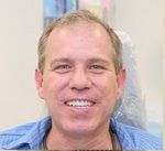 After Dental Implants and Same Day Dentures St. Louis MO