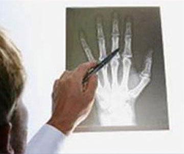 DR. JOSÉ MANUEL AGUILERA ZEPEDA - médico ortopedista