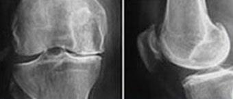 DR. JOSÉ MANUEL AGUILERA ZEPEDA - cirugía ortopédica