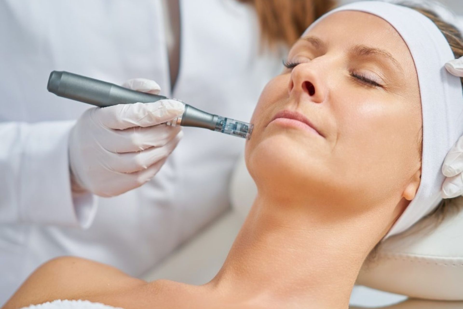 Skin Needling: un ago in aiuto della nostra pelle