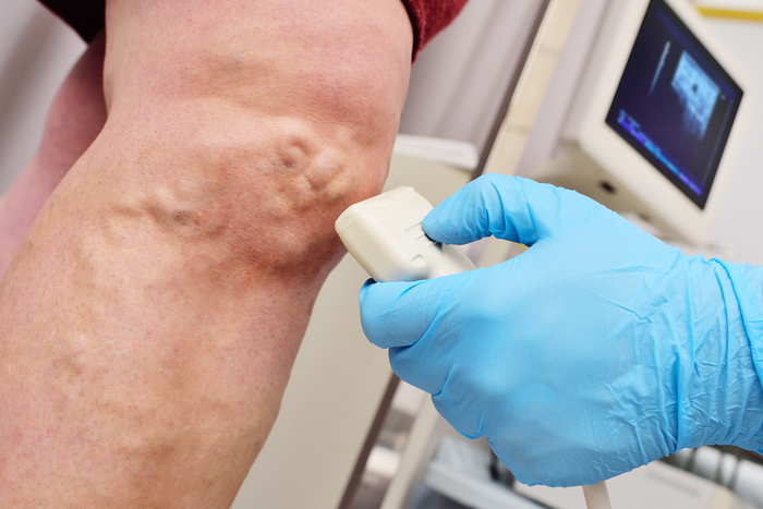 biostimolazione