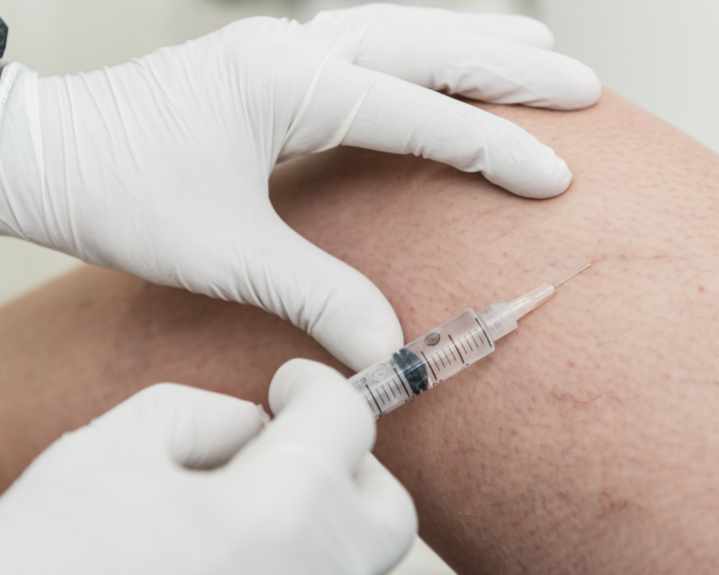 scleroterapia