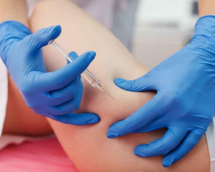 mesoterapia