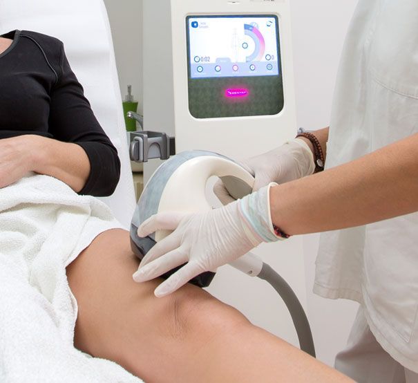 velashape3