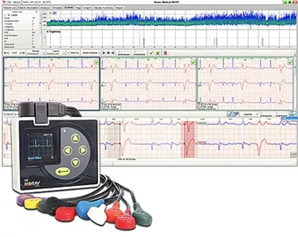 A heart monitor with a bunch of wires attached to it