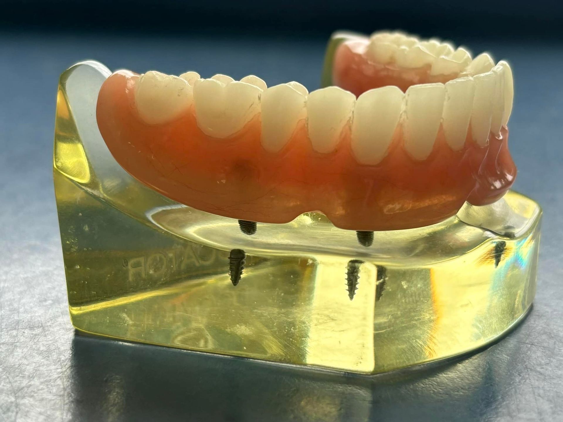 Dental Dentures on a Yellow Display Block, With Pink Gums and White Teeth — Precise Dentures in Berserker, QLD