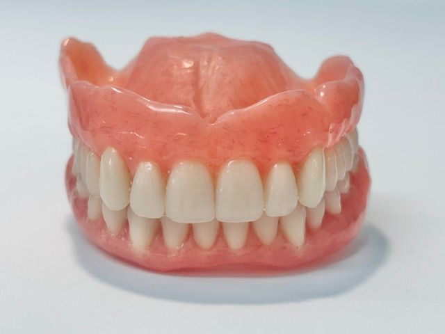 Dental Model With Several Front Teeth and Pink Gums, Showing Chipped and Missing Teeth — Precise Dentures in Berserker, QLD