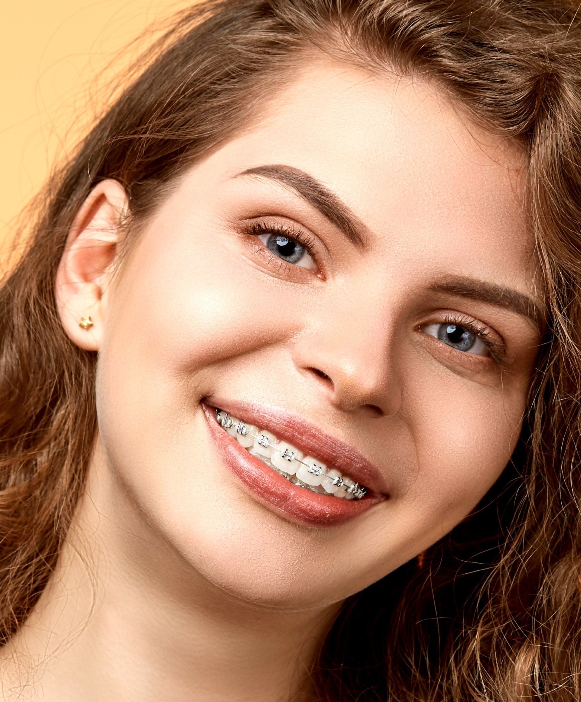 Persona sonriente con aparatos dentales y cabello castaño ondulado sobre un fondo beige cálido.