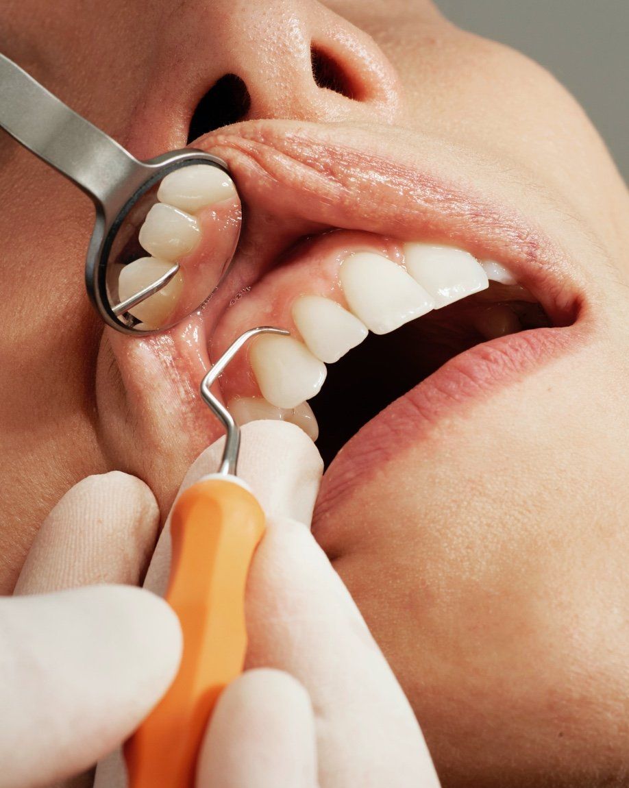 Primer plano de un dentista limpiando los dientes de un paciente con un instrumento y un espejo.