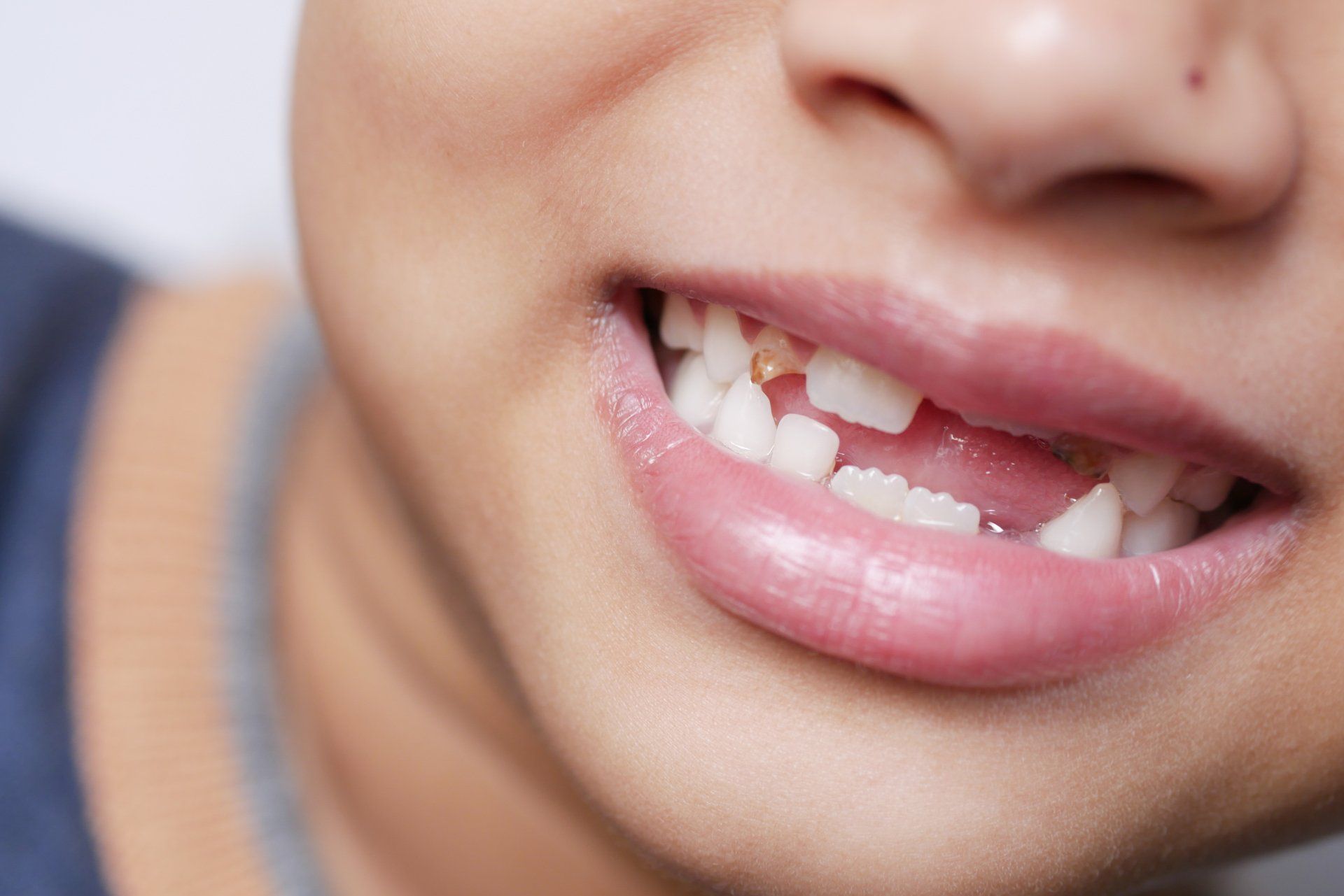 pediatric dentistry