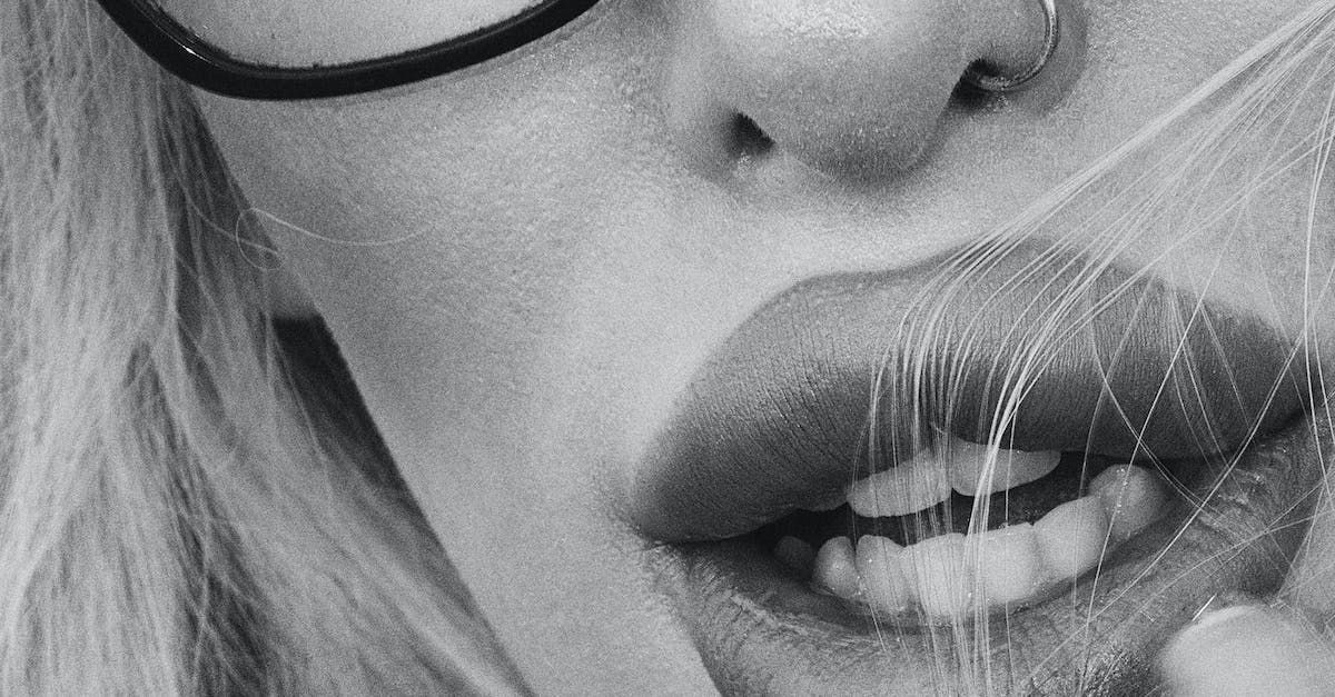 Close-up of a patient's lips being treated with soft tissue fillers