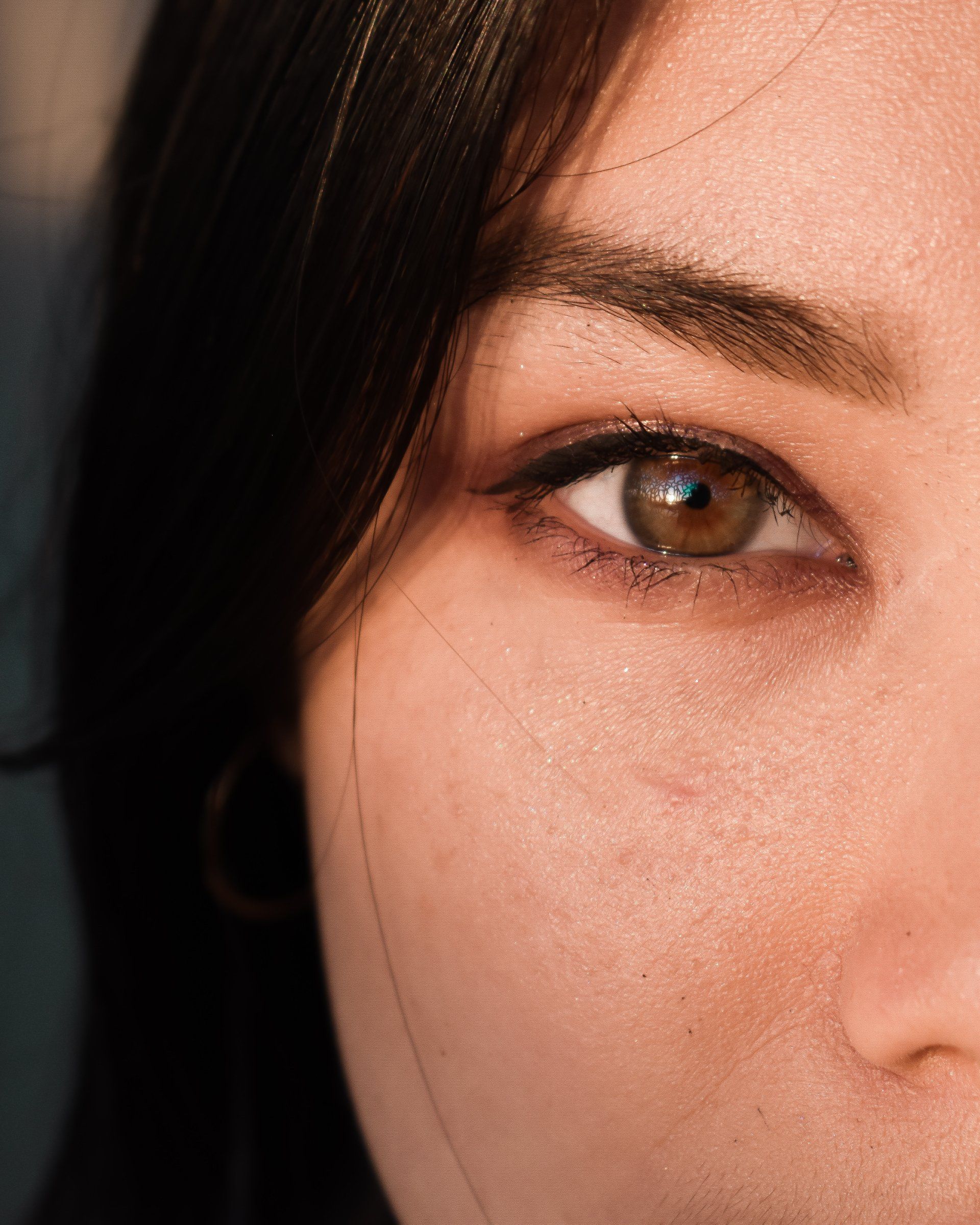 Eyelid