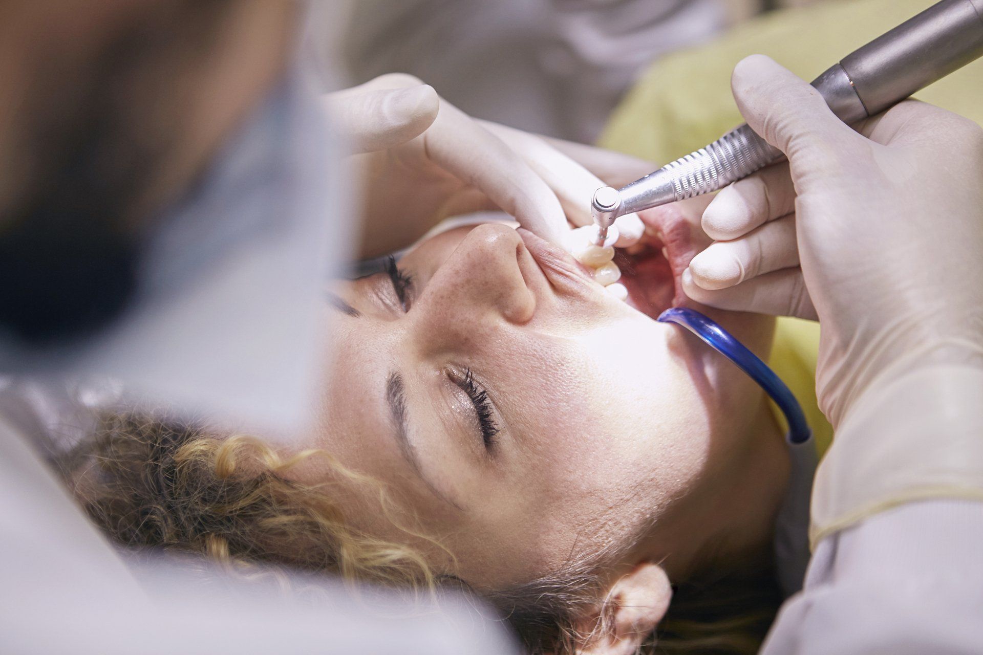 Dentist working on a patient's open mouth. Patient's eyes closed. Dental drill and suction tube visible.