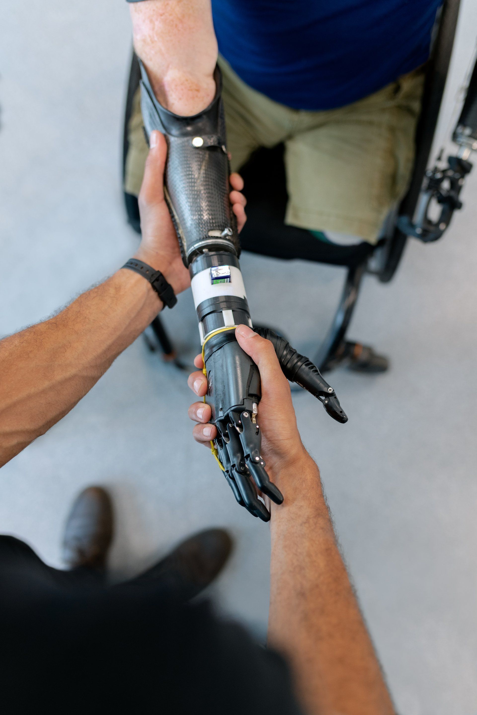 Person holding a black prosthetic arm while adjusting it in a clinical setting