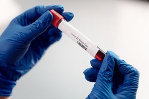 Check-up del metabolismo