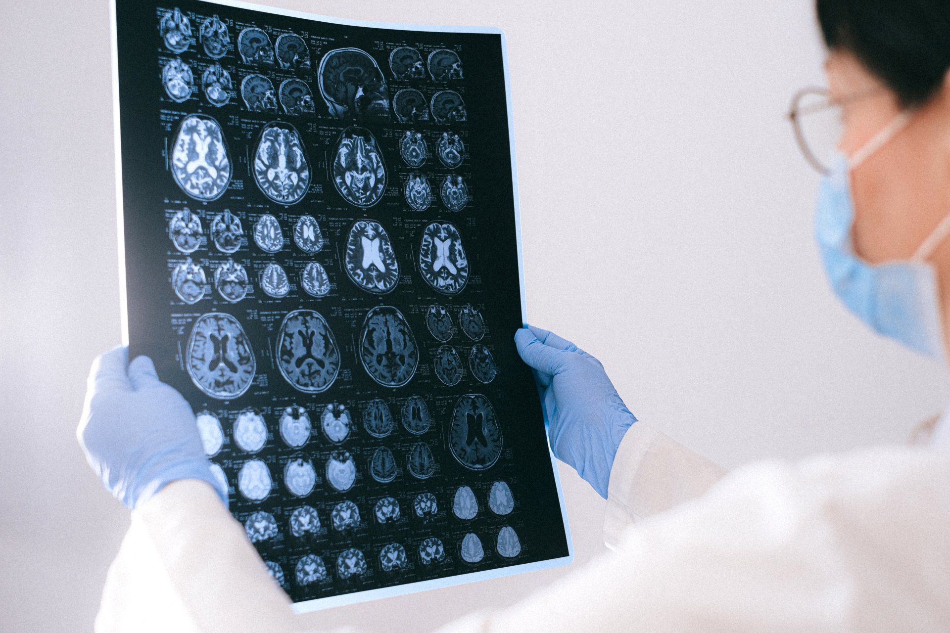 A doctor is holding a x-ray of a person 's brain.