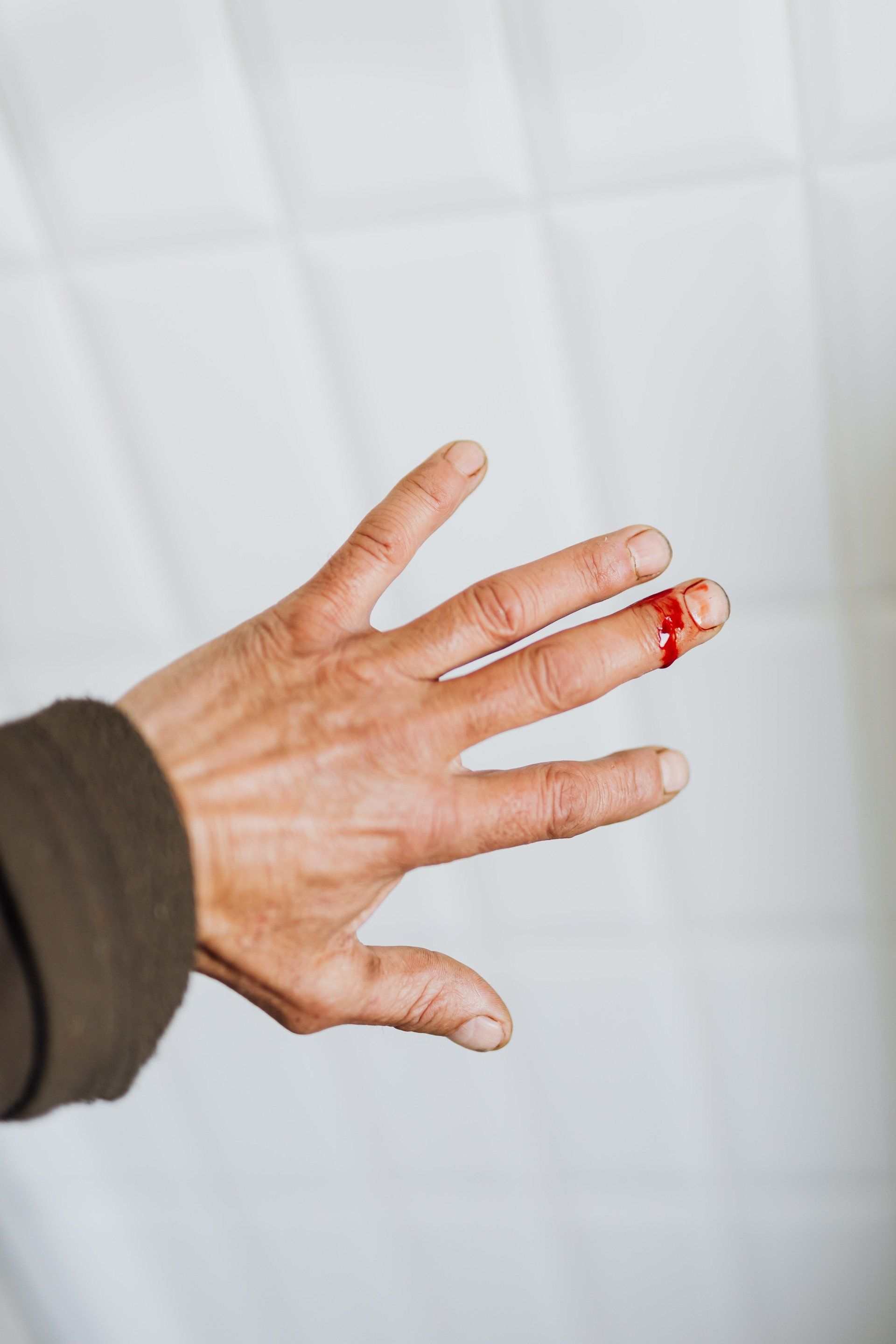 Hand mit Schnittwunde am Finger, blutend. Vor weißem Hintergrund.