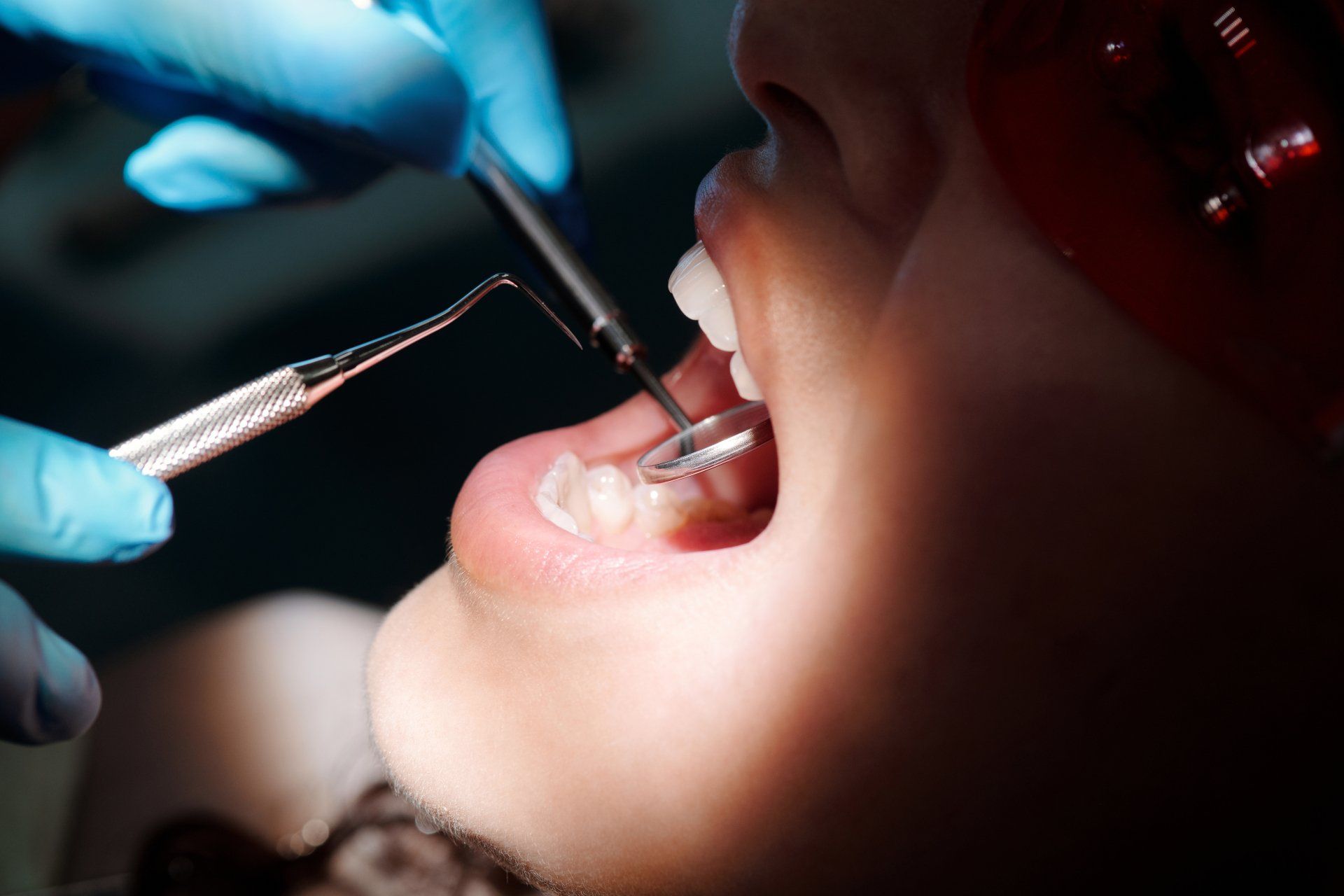 Dentist examining a patient's teeth with instruments; mouth open, tools reflected in a mirror.
