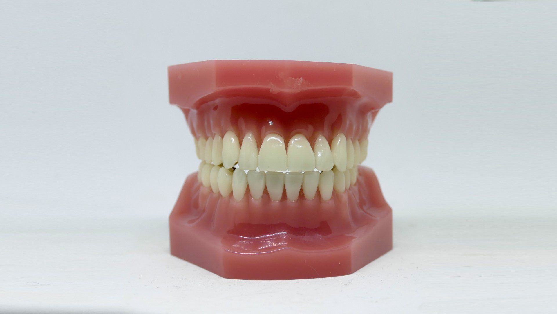 Does Enamel Remineralization Really Work?
