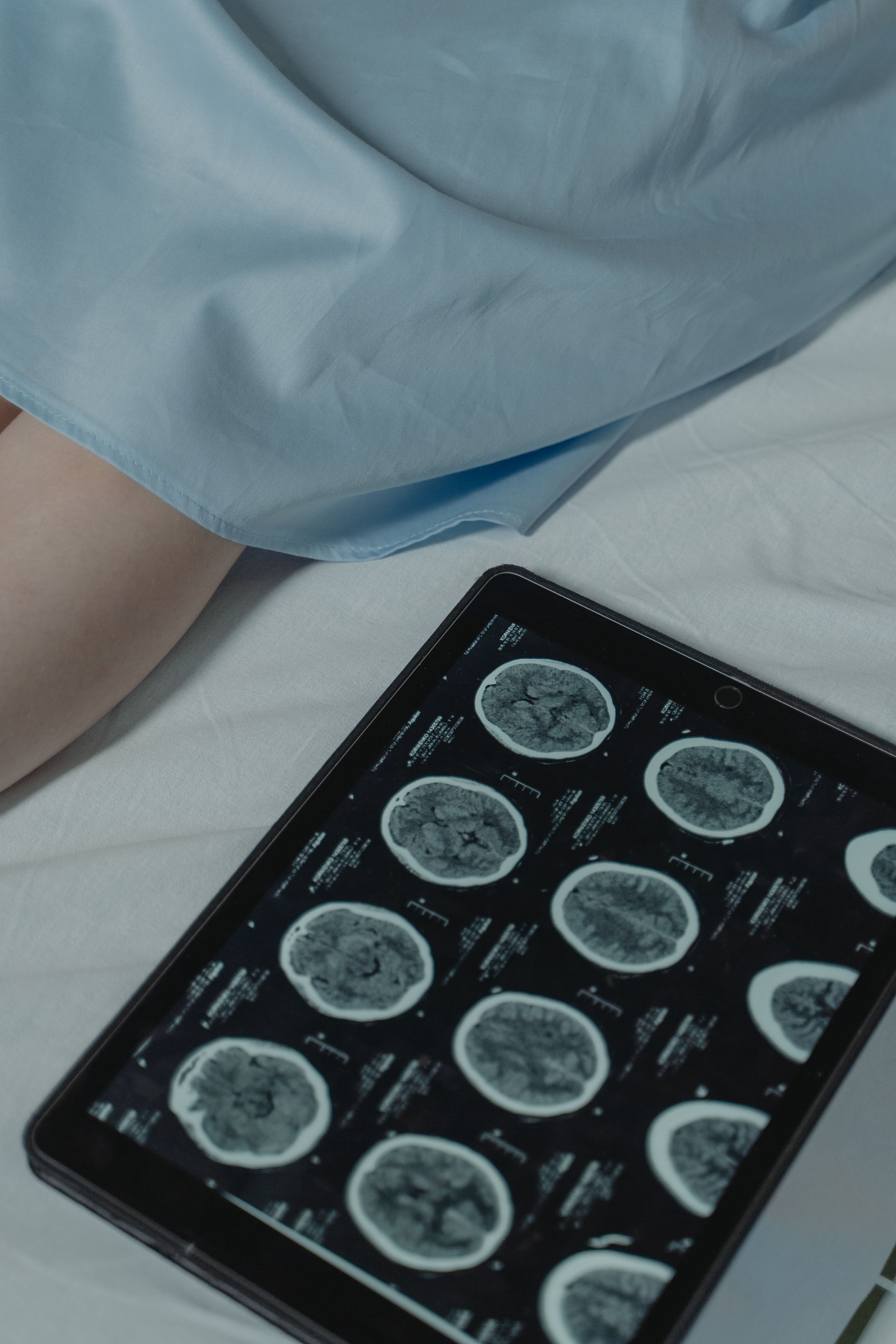 A tablet with a picture of a person 's brain on it