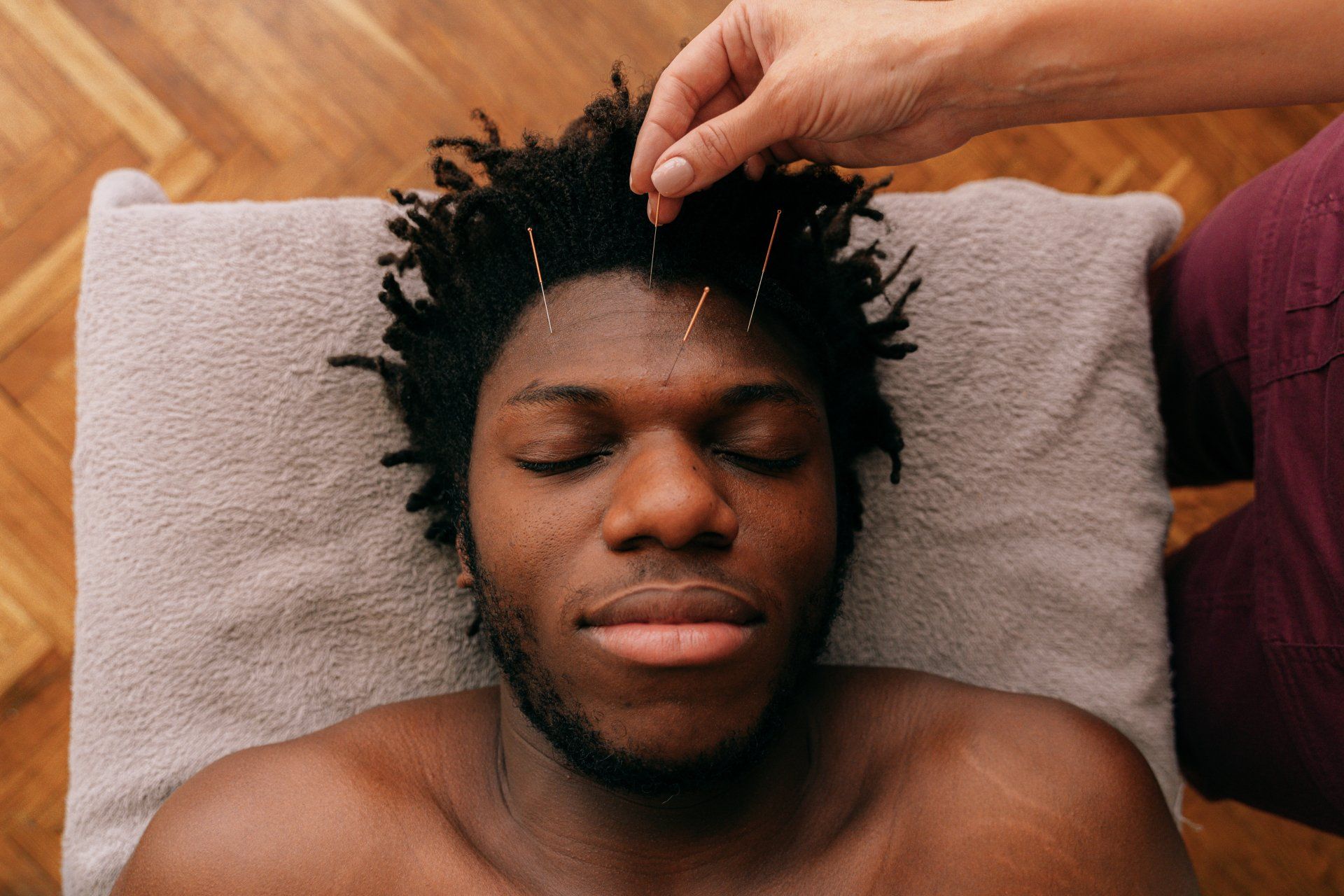 Man receiving acupuncture treatment on forehead. Hands holding needles above his closed eyes.
