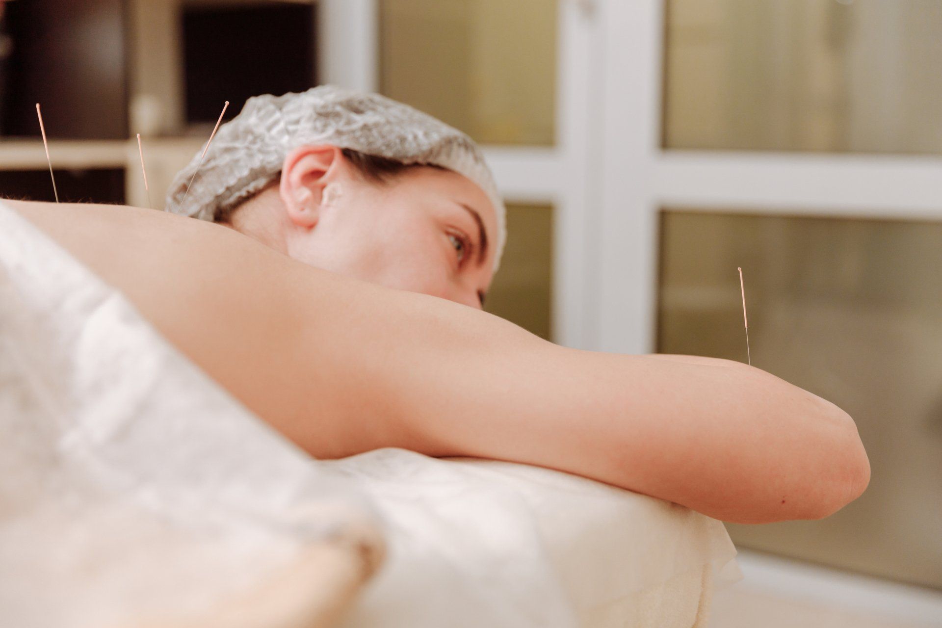 West Palm Beach Pain Management Acupuncture