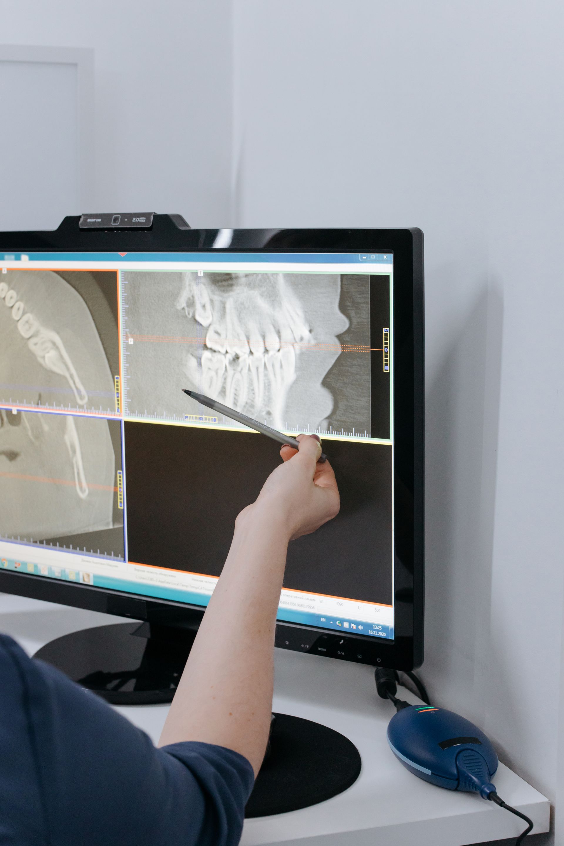 Person points at dental X-ray images on a computer screen in a medical setting.