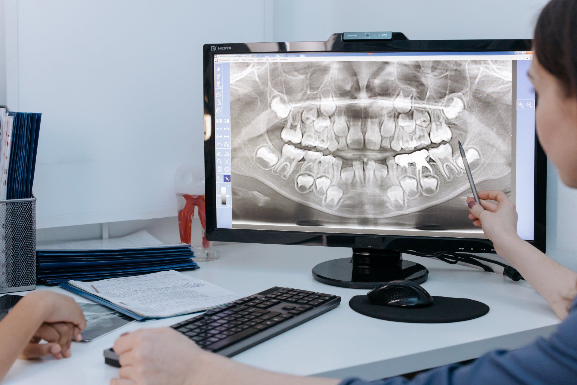 Dental x-ray