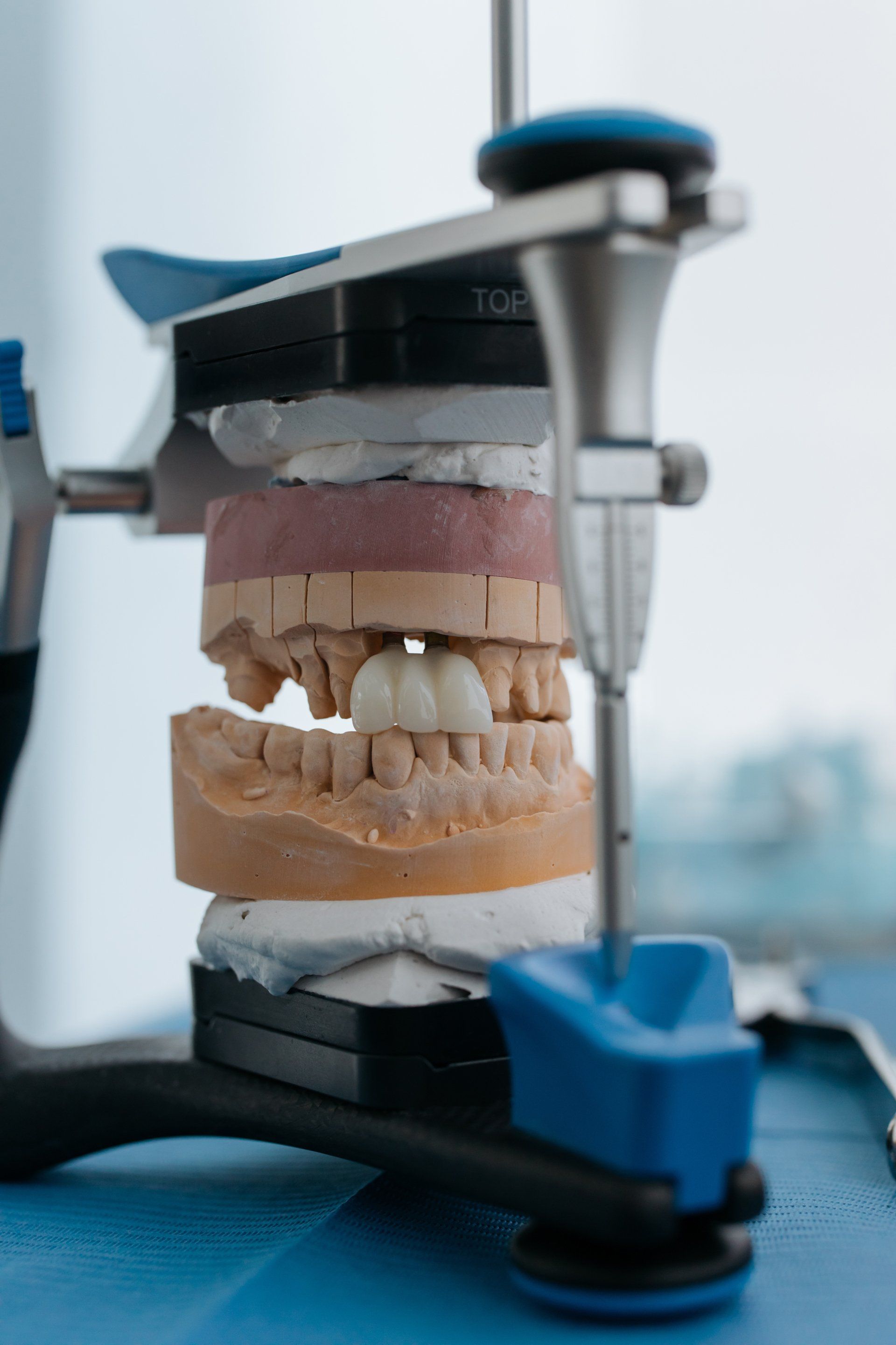 dentures