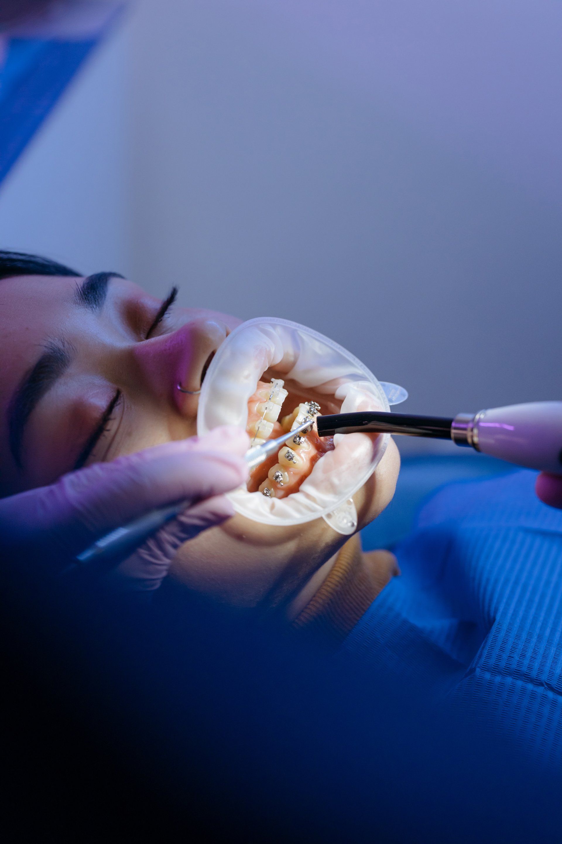 Dentist working on patient’s open mouth with tools under blue clinical lighting