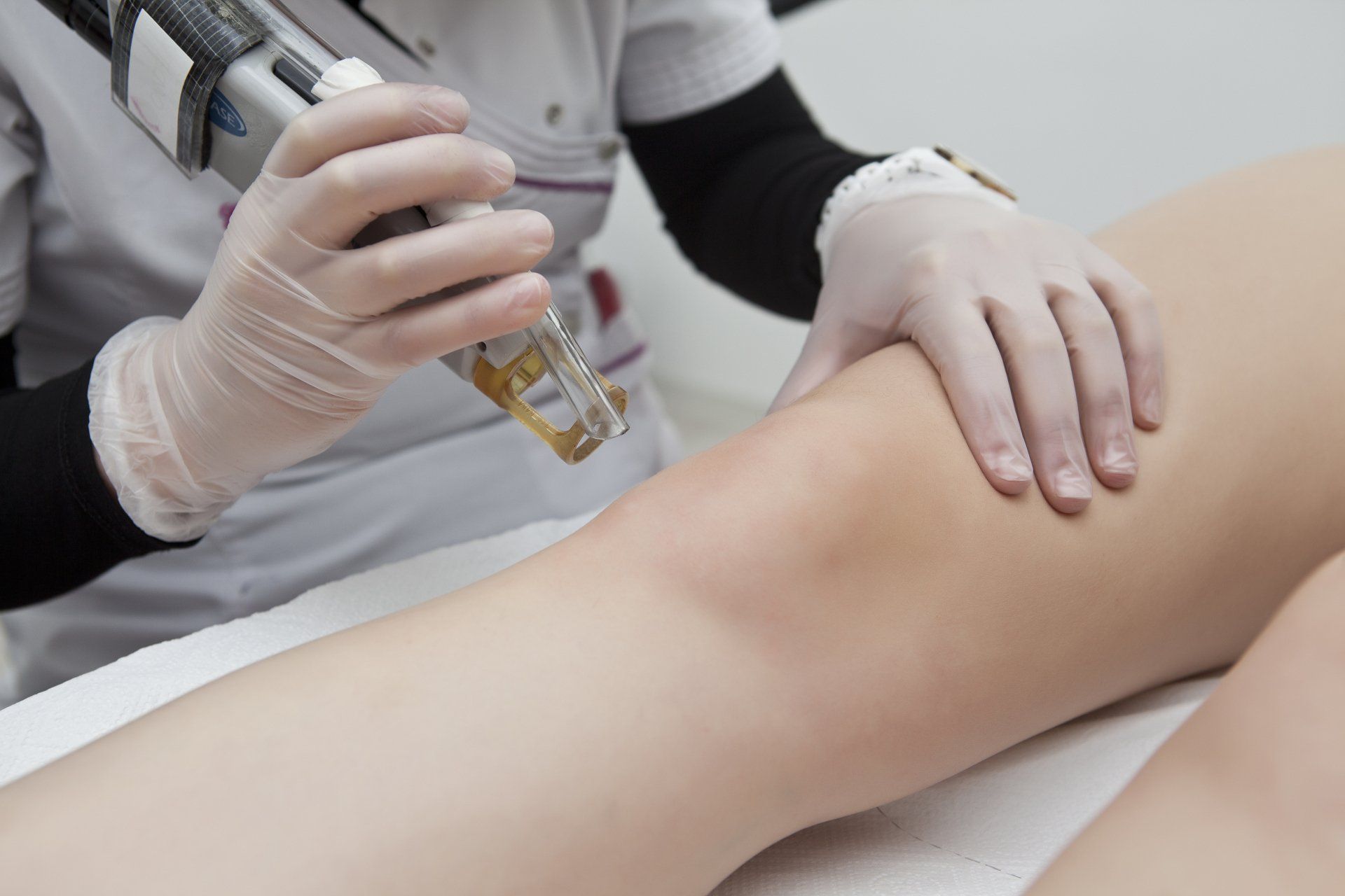 Medical aesthetic provider performing a laser treatment on a client’s leg