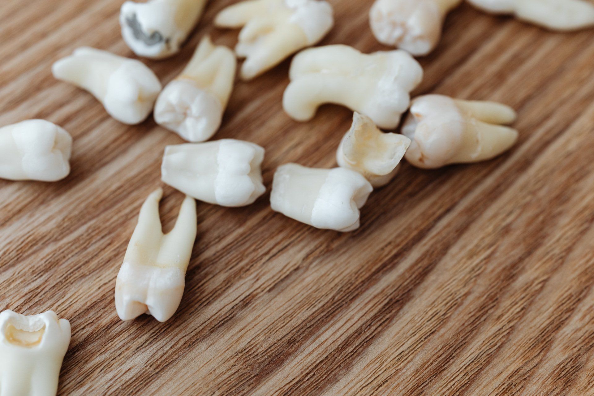 Signs You Need a Root Canal
