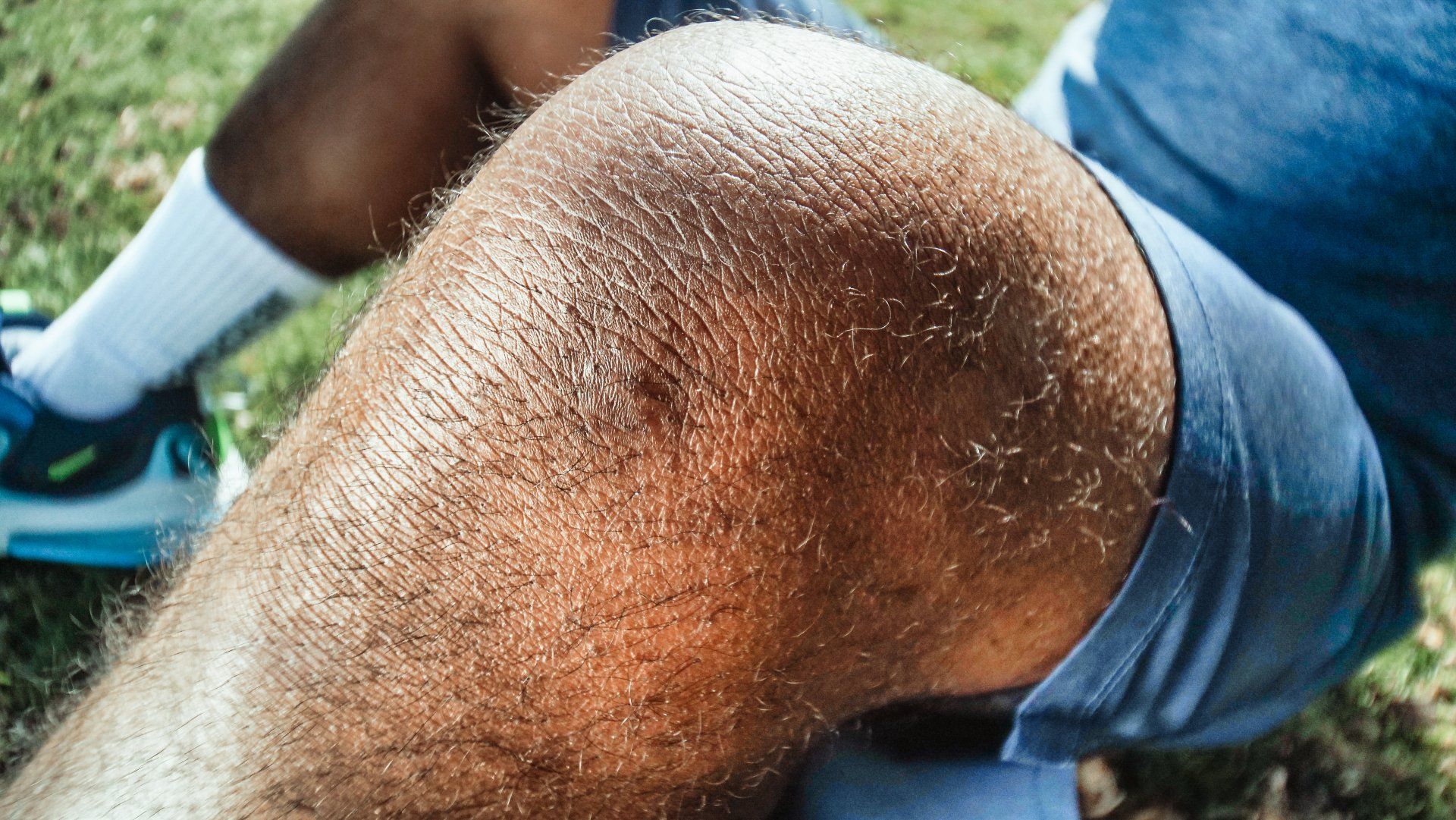 Bent, inflamed, swollen knee