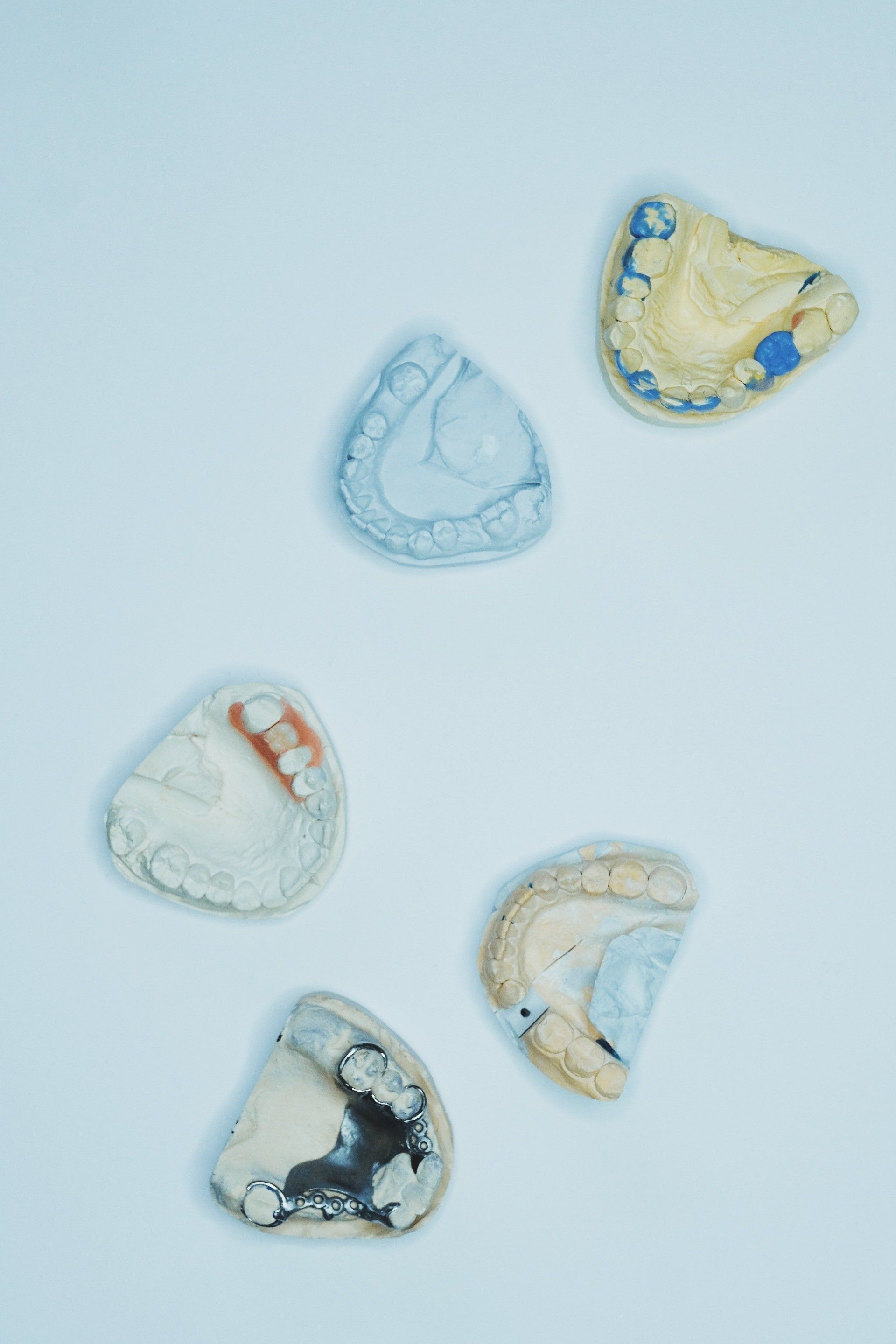 Five Dental Impressions in Various Colors, on a Light Blue Surface — The Denture Care Group Sunshine Coast in Caloundra, QLD