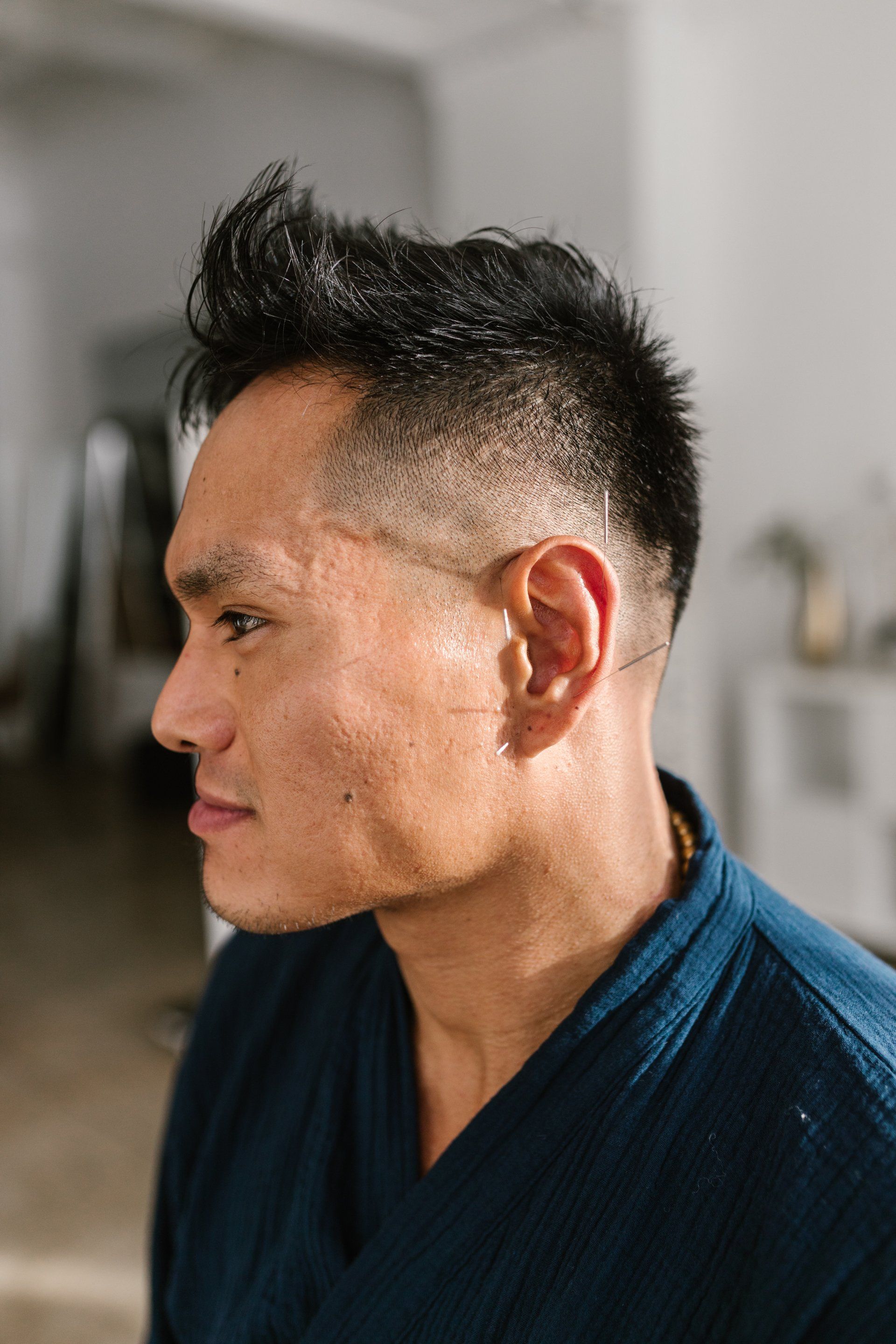 Auricular Therapy by Dr. Ruth Diez in Orlando Fl.