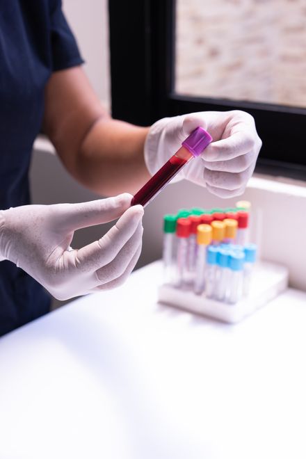 doctor holding blood sample vial with white latex gloves on