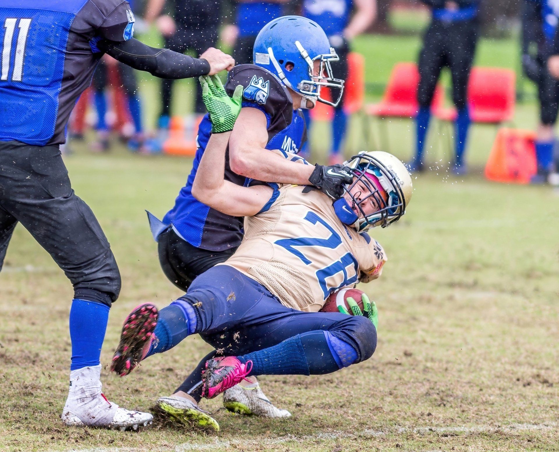 What is a concussion?