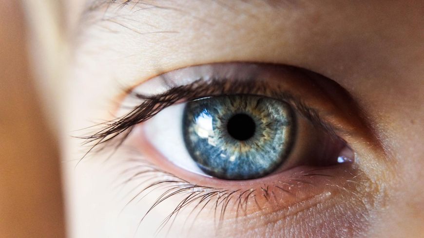Ojo