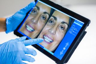 Cosmetic dentistry in Louisville, KY | Sparkle and Shine Dental
